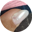 fungo_descolamento_infiltracao_alongamento de unha de gel ficha anamnese importante Nail designer 9